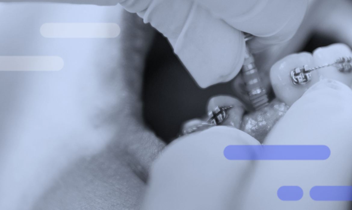 Basic Implant Program