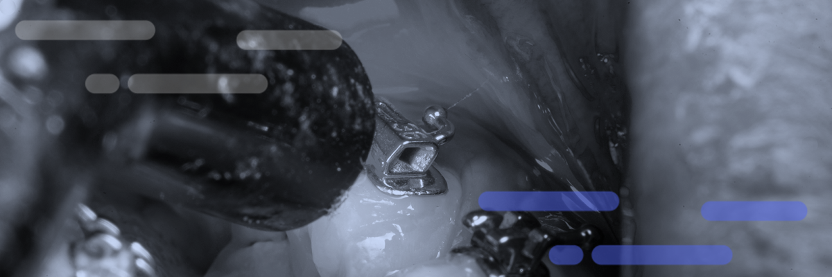 Complete Guide Orthodontic Program